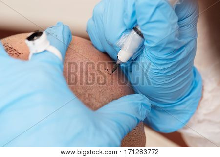 professional tattooist making permanent make up tricopigmentation