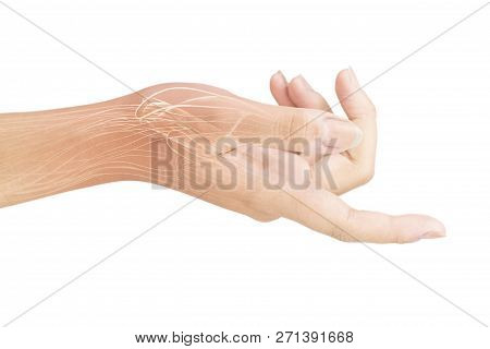 Wrist Muscle Injury White Background Wrist Pain