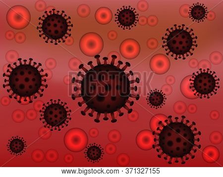 Virus And Bacterial Cell Of Pneumonia, Medical Background. Coronavirus 2019-ncov. Danger, Risk Of Di