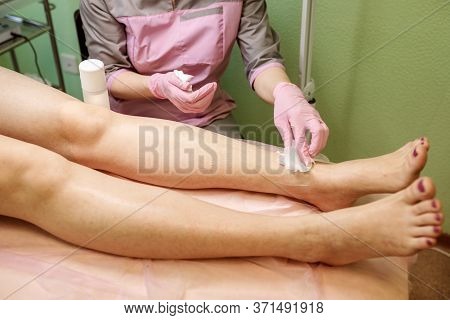 Beautician Doctor Is Cleaninig Clients Legs Befor Or After Epilation Procedure.