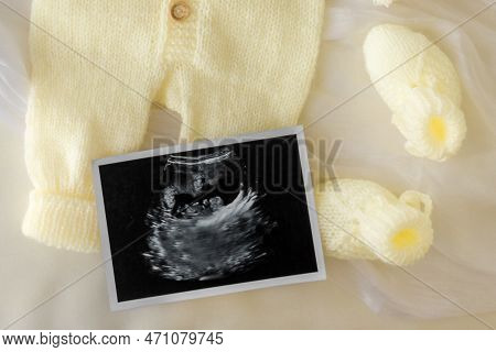Mockup Of Social Media Baby Announcement. Pregnancy Announcement Background With Blurred . Selective