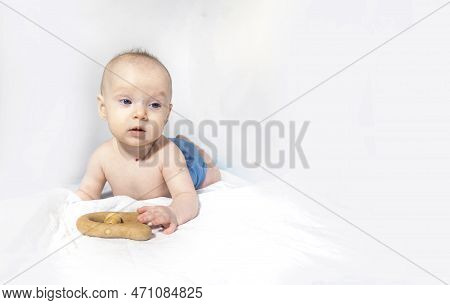 A Baby With A Hemangioma On His Neck Lies On A White Background. A Five-month-old Girl In A Reusable