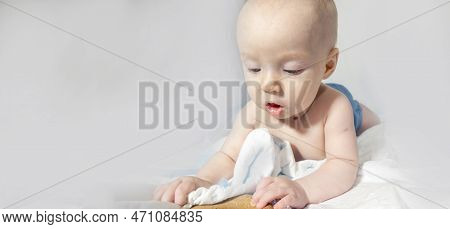 A Baby With A Hemangioma On His Neck Lies On A White Background. Banner With A Copy Space. Profile O
