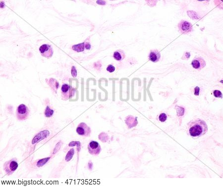 Plasma Cells Are B Lymphocytes Activated By The Presence Of Antigens That Secrete Large Quantities O