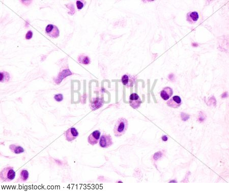 Plasma Cells Are B Lymphocytes Activated By The Presence Of Antigens That Secrete Large Quantities O