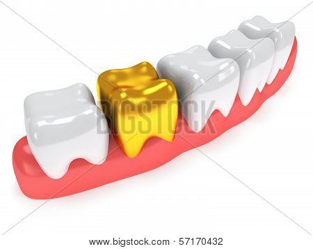 Teeth on gingiva isolated on white back.