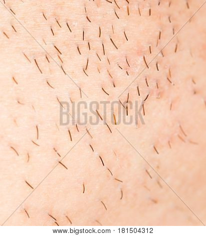 bristles on the skin. close-up . A photo