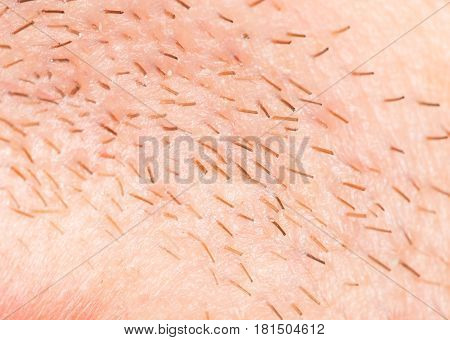 bristles on the skin. close-up . A photo