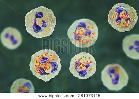 Bacteria Neisseria Gonorrhoeae Inside Neutrophils, Gonoccoccus, Diplococci That Cause Sexually Trans