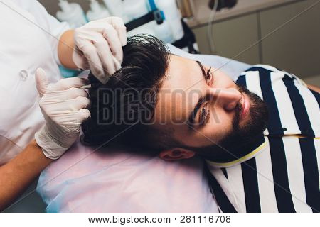 Treatment Of Baldness With Beauty Injections. Mesotherapy. Plasma Lifting.