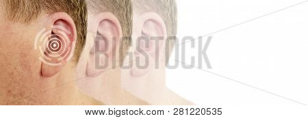 Hearing Loss Male Symptom Problem Otitis Defect