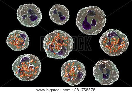 Bacteria Neisseria Gonorrhoeae Inside Neutrophils, Gonoccoccus, Diplococci That Cause Sexually Trans