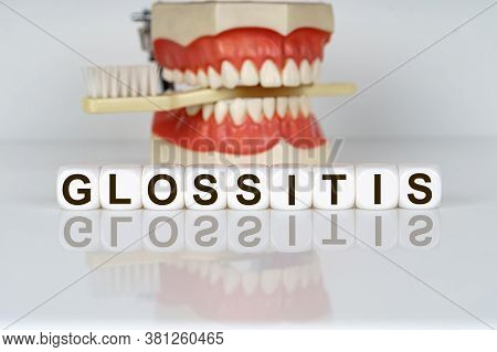 Medical, Dental Concept. The Text Is Written On The Cubes - Glossitis. In The Background, A Model Of