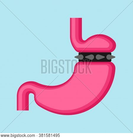 Stomach Banding Isolated. Adjustable Gastric Band. Vector Illustration