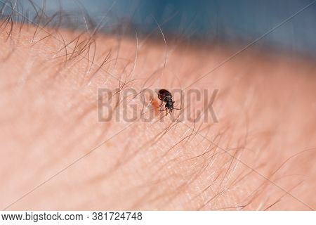 A Small Black Insect Sits On A Hand Close-up. Insect In The Palm Of Your Hand. Close-up
