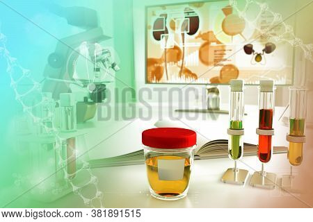 Urine Sample Test For Crystals Or Cystine - Test Tubes In Modern Biochemistry Study Office, Medical 