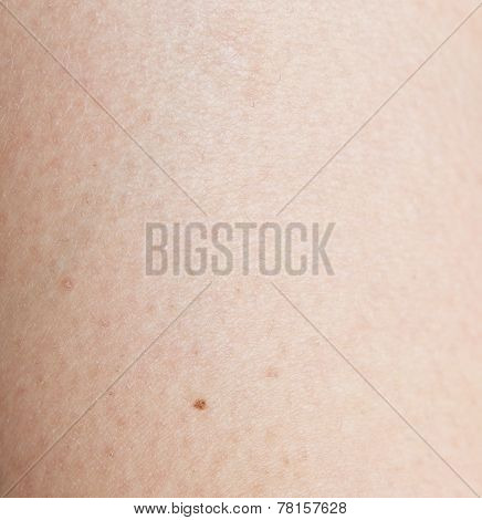 Human Skin