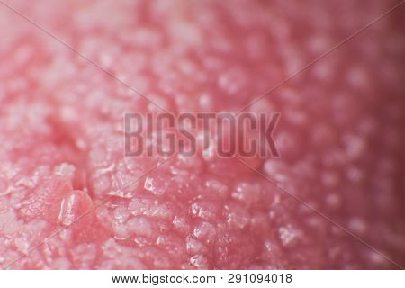 Super Macro Surface Of Tongue Candidiasis Overgrowth