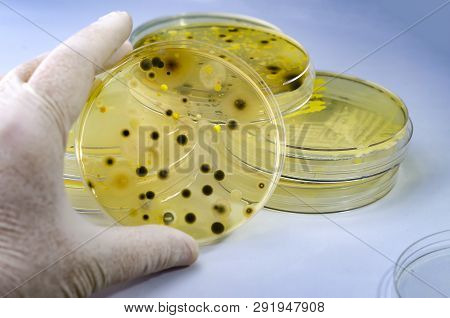 Colonies Of Different Bacteria And Mold Fungi Grown On Petri Dish With Nutrient Agar, Close-up View.