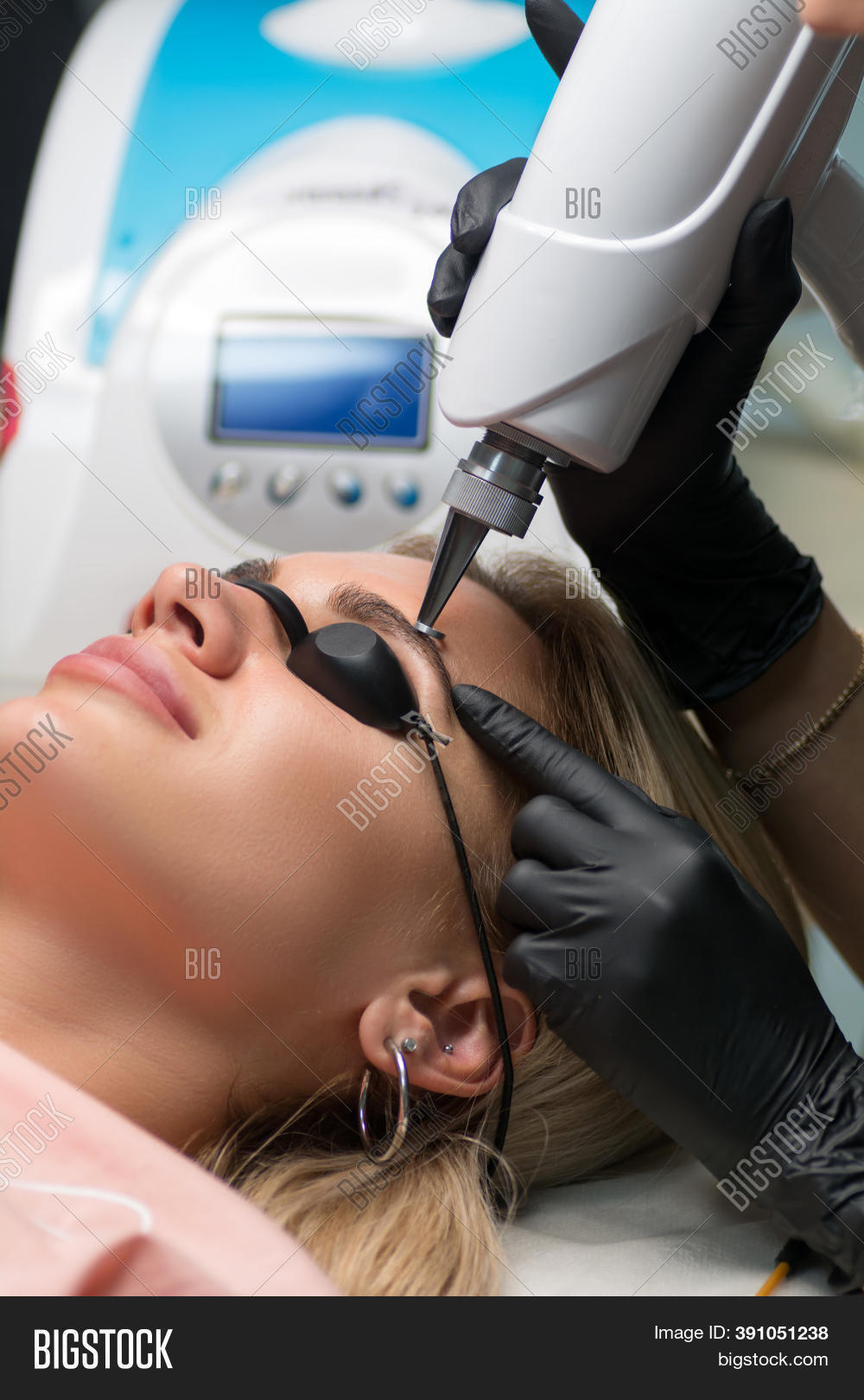 Laser Removal Image & Photo (Free Trial) | Bigstock