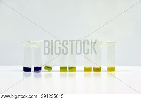 Micro Centrifuge Tubes Of Samples For Testing Anti-biotic In Beef Or Meats By Using Test Kit Sample 