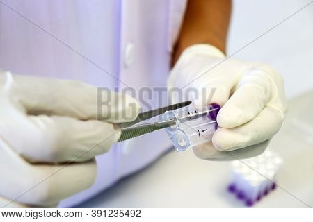 Scientist Holding Micro Centrifuge Tubes And Forceps For Testing Anti-biotic In Beef Or Meats By Usi