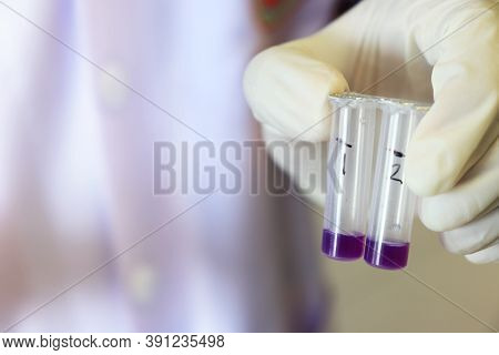 Scientist Holding Micro Centrifuge Tubes For Testing Anti-biotic In Beef Or Meats By Using Test Kit 