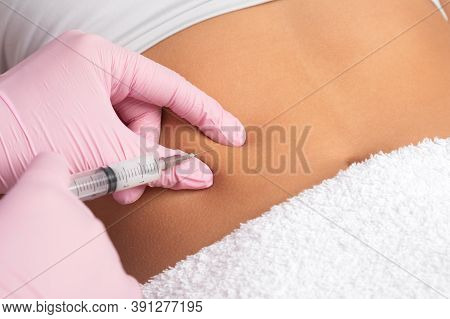 A Doctor Of Aesthetic Cosmetology Makes Lipolytic Injections To Burn Body Fat On A Woman’s Stomach A