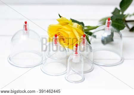 Jars For Hijama On A White Wooden Background And Yellow Flowers. Bloodletting. Sunnah Treatment. Isl