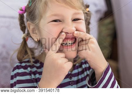 Adult Permanent Teeth Coming In Front Of The Child's Baby Teeth: Shark Teeth. Little Girl's Open Mou