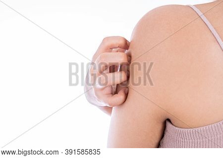 Female Scratching Her Arm Isolated White Background. Medical, Healthcare For Advertising Concept.