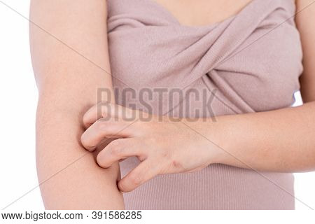 Female Scratching Her Arm Isolated White Background. Medical, Healthcare For Advertising Concept.