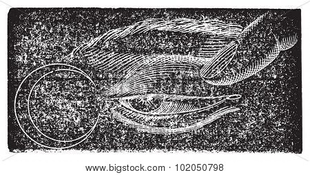 Phosphene nasal, vintage engraved illustration. Usual Medicine Dictionary - Paul Labarthe - 1885. 