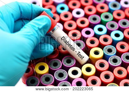 Test tube with blood sample for diabetes test