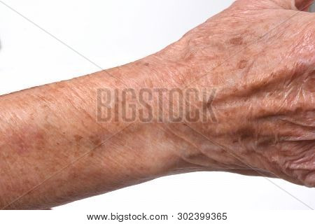 Detail Of The Texture Of A Senior Woman's Skin