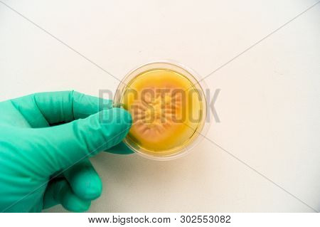 Mold Grown On A Sabouraud Agar Medium In A Petri Dish.