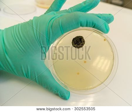 Mold Grown On A Sabouraud Agar Medium In A Petri Dish.