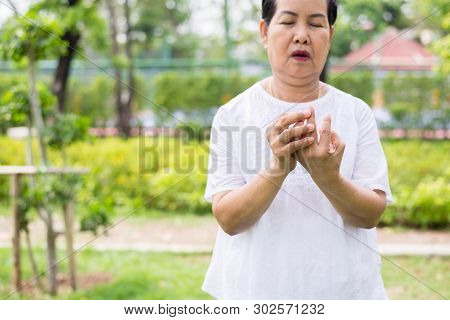 Elderly Asian Female With Beriberi On Hand Or Finger,disease Causing Inflammation Of The Nerves