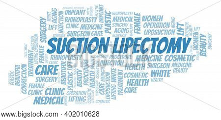 Suction Lipectomy Typography Word Cloud Create With The Text Only. Type Of Plastic Surgery