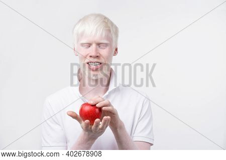 Albinism Albino Man In Studio Dressed T-shirt Isolated On A White Background. Abnormal Deviations. U