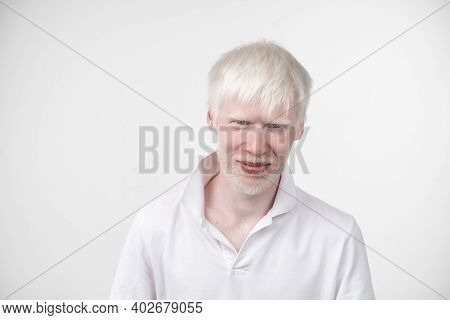 Albinism Albino Man In Studio Dressed T-shirt Isolated On A White Background. Abnormal Deviations. U