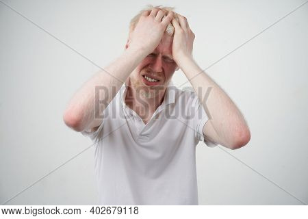 Albinism Sad Albino Man White Skin Hair Studio Dressed T-shirt Isolated White Background. Abnormal D