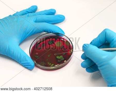 Scientist Analysis Escherichia Coli (e.coli) Culture With Eosin Methylene Blue (emb) Agar In Petri D