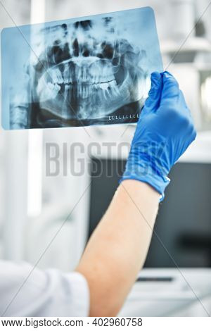 Picture Of Female Doctor Or Dentist Looking At X-ray