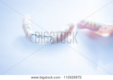 Removable Partial Dentures