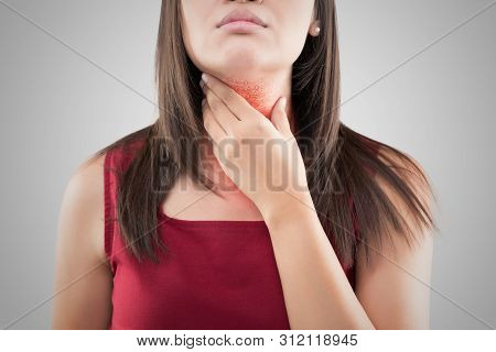 Sore Throat. Red Around The Itching Area. Concept With Healthcare And Medicine.