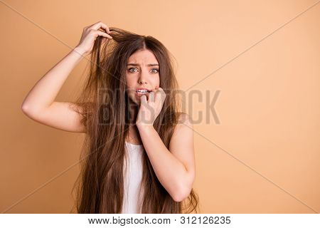 Close-up Portrait Of Her She Nice-looking Attractive Worried Lady Biting Nails Touching Unhealthy Th