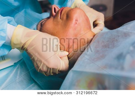 Aged Woman Doing Mesothreads And Thread Lifting, Cosmetology. Cosmetic Procedure To Eliminate Signs 