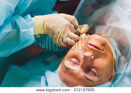 Aged Woman Doing Mesothreads And Thread Lifting, Cosmetology. Cosmetic Procedure To Eliminate Signs 