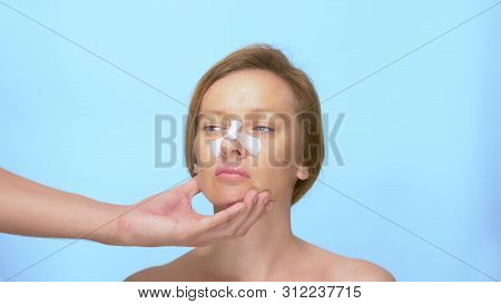 The Concept Of Plastic Surgery. Rhinoplasty. The Hands Of The Doctor Hold The Womans Face With A Ban